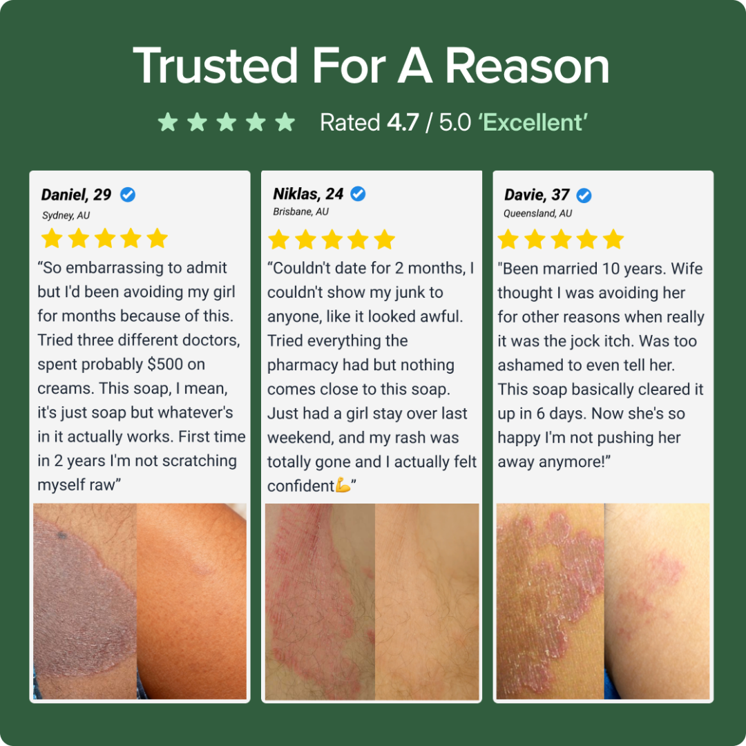 Soothe Antifungal Soap For Jock Itch